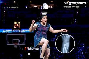 🐐顶碗大妈声明：独轮车踏板运输受损 左手腕严重骨折😢